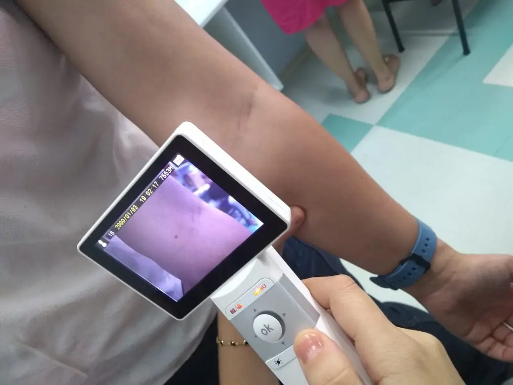 dermatoscopio