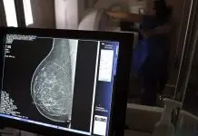 Exame de mamografia | Câncer de mama