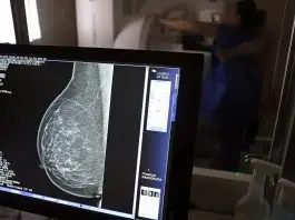 Exame de mamografia | Câncer de mama