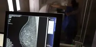 Exame de mamografia | Câncer de mama