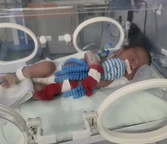 UTI neonatal de São José recebe 65 polvinhos de crochê feitos por voluntárias Polvo UTI neonatal SJC